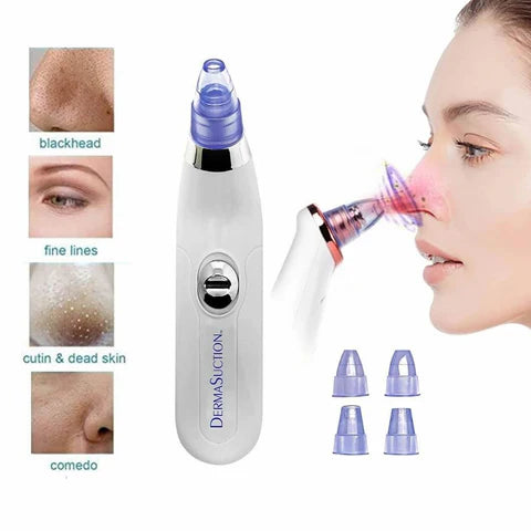 Derma Suction Blackhead Remover Device – Pore Cleaner