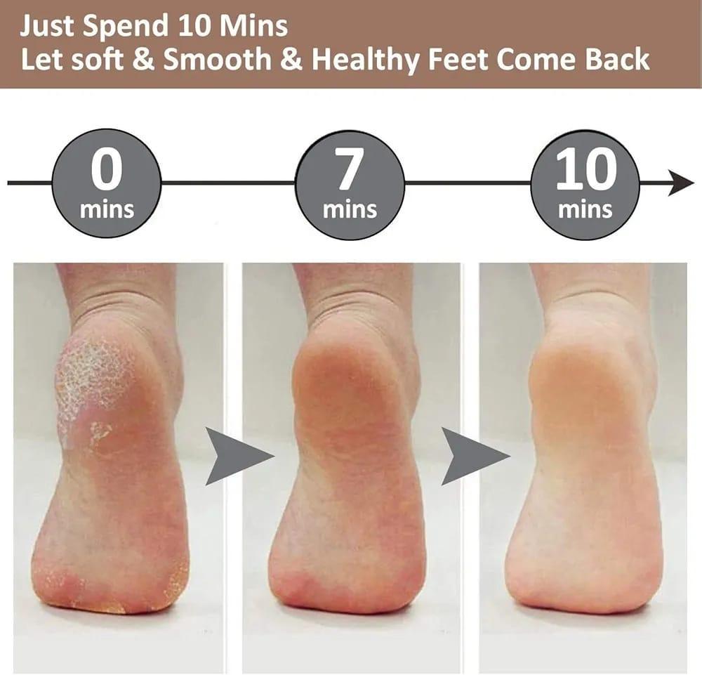 Electric Foot Callus Scrubber, Replaceable Heads |