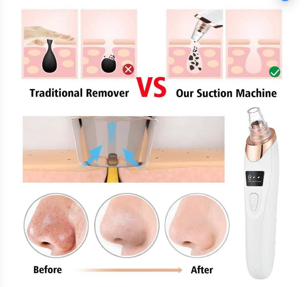 -Blackheads Remover Pore Cleaner