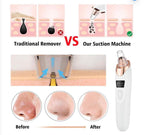 -Blackheads Remover Pore Cleaner