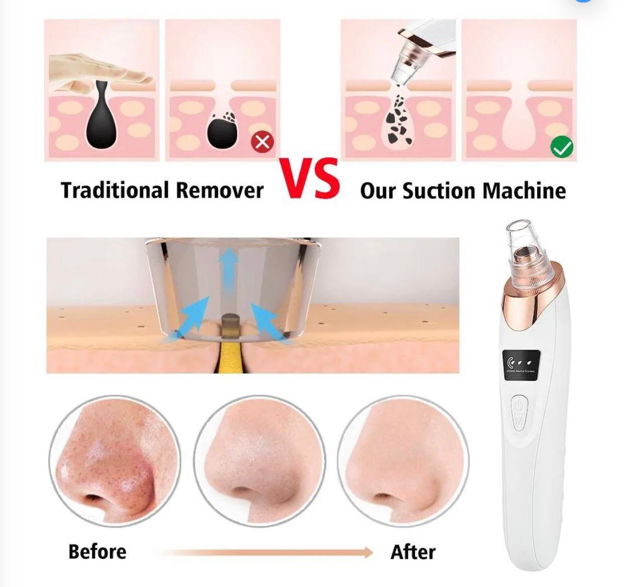 -Blackheads Remover Pore Cleaner