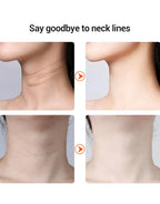 Face lifting Instrument <Imported>